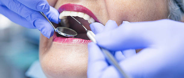 Best Emergency Dentist for Knocked-Out Tooth in East Pepperell, MA